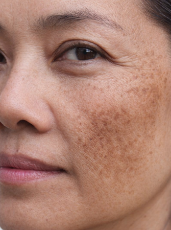 95bcb073ce0becbb05d0588a13c307652fb3e010